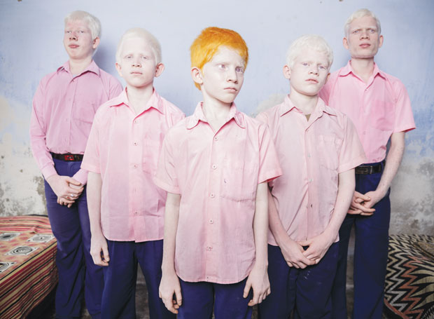 Gente. Crianças albinas na Índia. Um grupo de garotos albinos cegos é fotografado na escola missionária para cegos Vivekananda, na Bengala Ocidental. A imagem de Brent Stirton para a Getty Images ficou em 1º lugar na categoria Retratos Posados | Brent Stirton/Getty Images