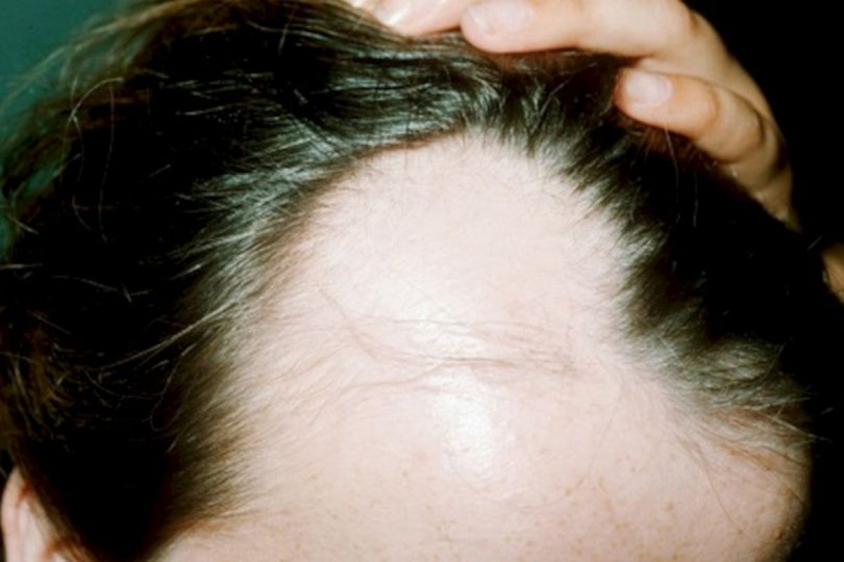 La máscara para la reconstitución de los cabello por los óleos etéricos