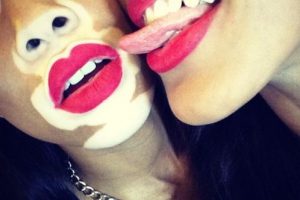 La cosmética contra las pecas y las manchas de pigmento