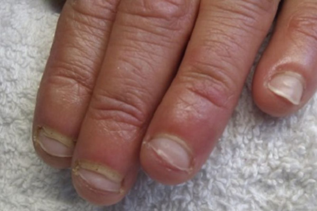 22 fotos que les harán dejar de morderse las uñas para ...
