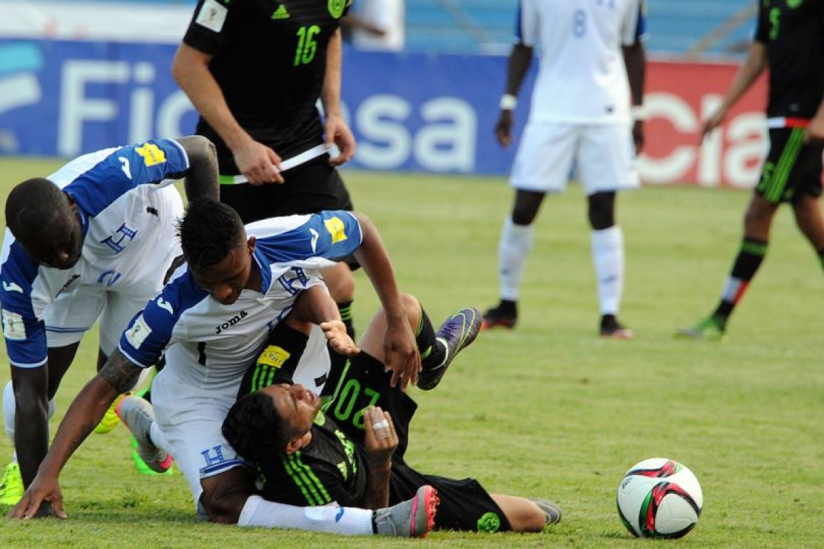 Las 11 lesiones más escalofriantes del fútbol | Publimetro Chile