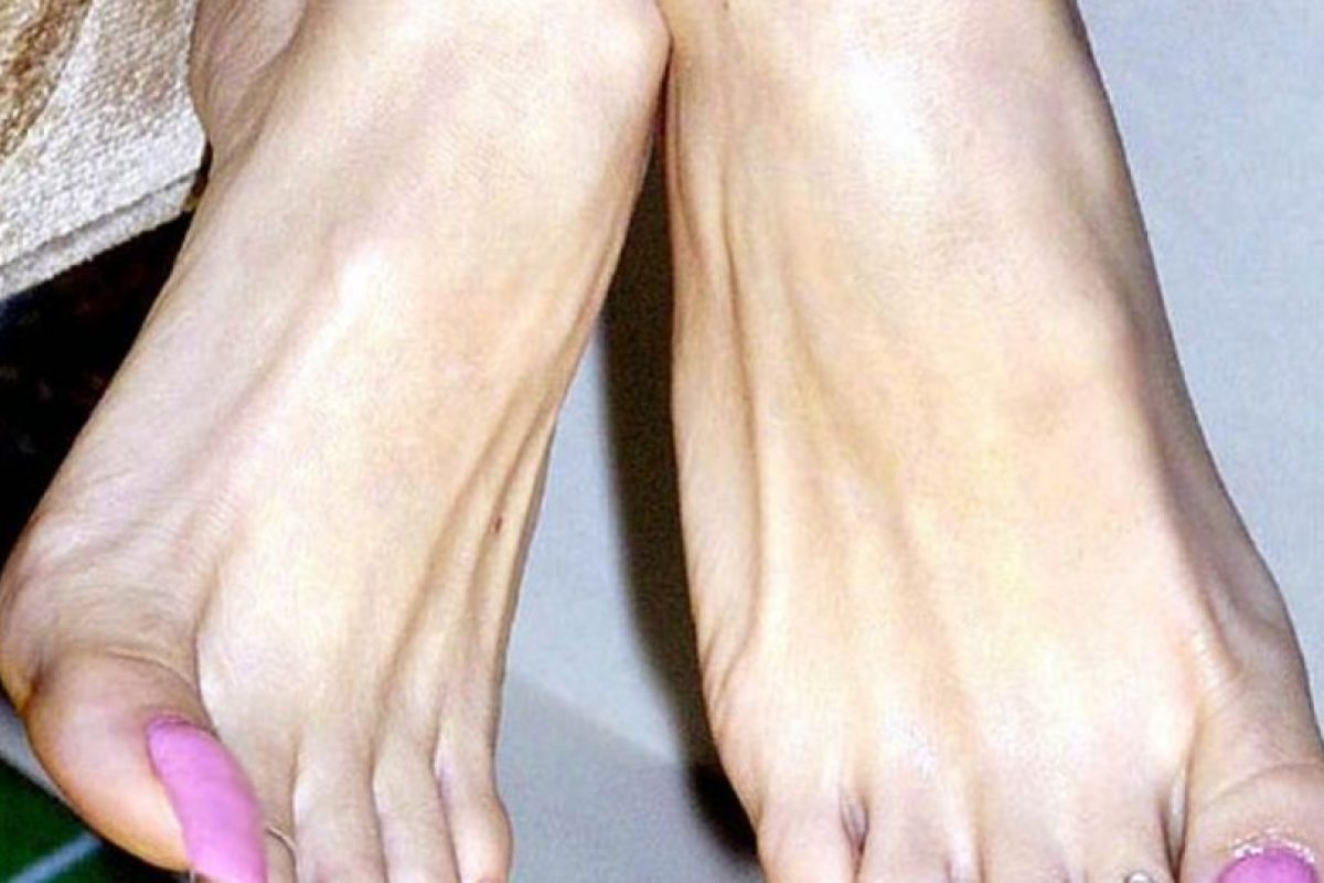 gusanos en las uñas delos pies gusanos en las uñas delos pies
