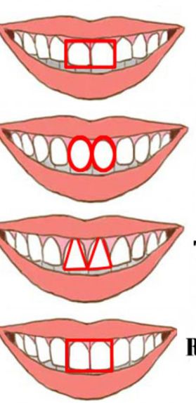 Dentaduras/Internet