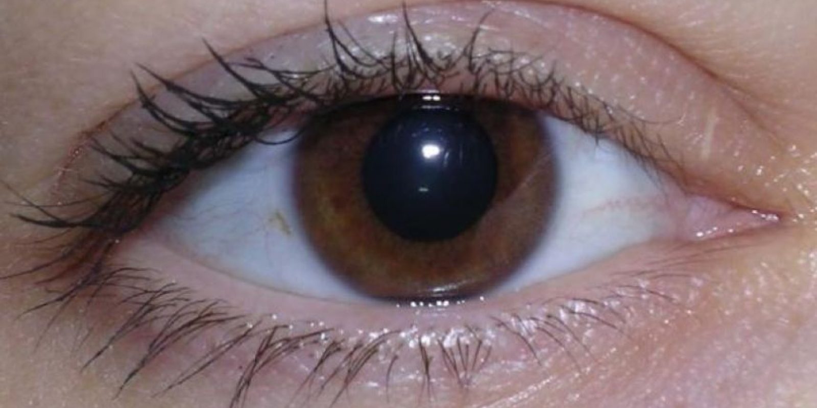 de dicen salud datos su ojos que Publinews sus 5 wSzXOUx
