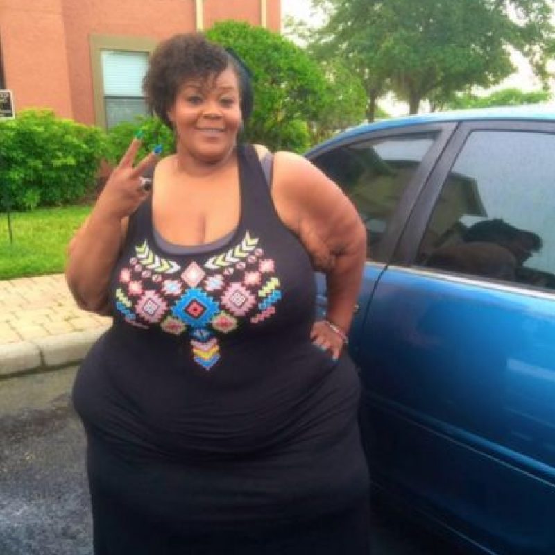 Fotos Así quedó "La Mujer más gorda del mundo" luego de perder 230